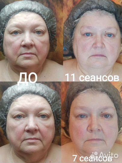 Депиляция, массаж, ламинирование