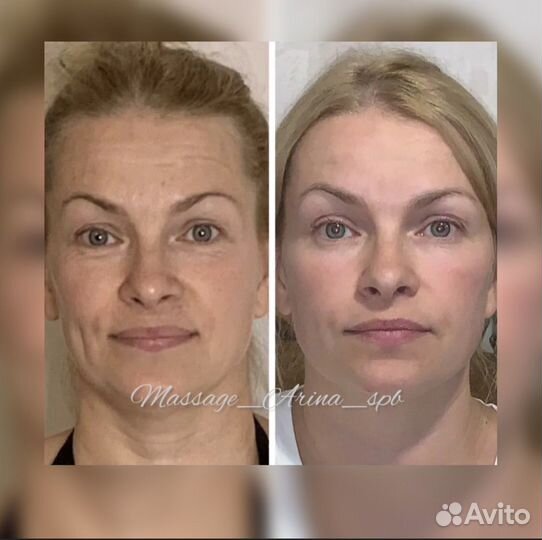 Массаж Лица/Тела.Липолитики.Обертывание