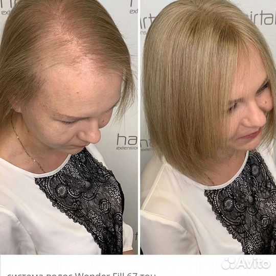 Парикмахерские услуги. Системы замещения волос