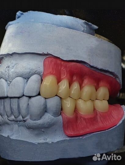 Услуги зубного техника