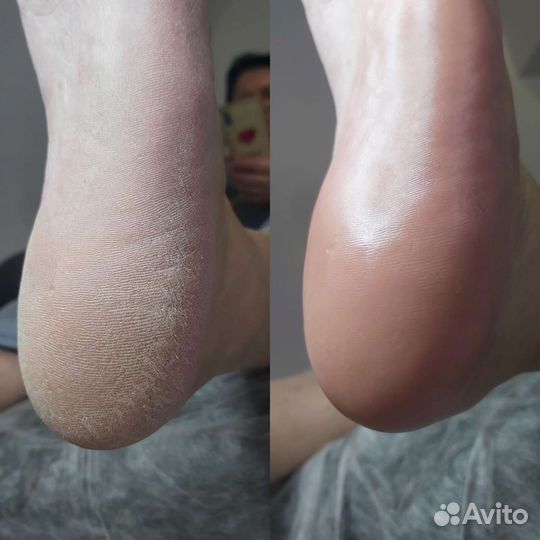 Смарт педикюр/маникюр Сочи Макаренко