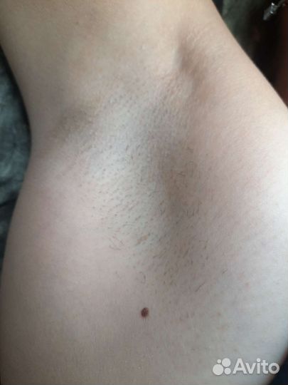 Депиляция воском,шугаринг