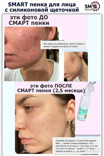 Пенка для лица