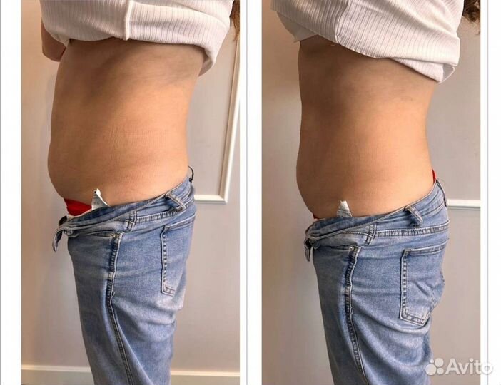 Супер сушка живота