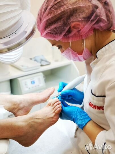 Подолог. Вросший ноготь. Мозоли. Грибок. Ортез