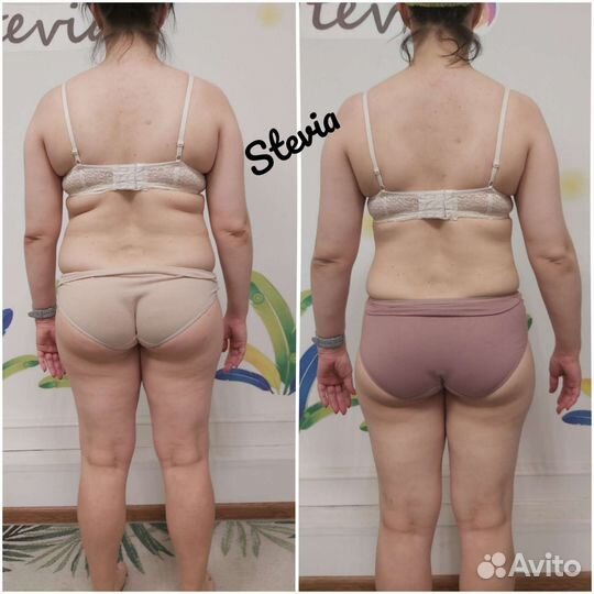 Lpg массаж м.Московская