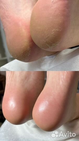 Маникюр, педикюр, наращивание