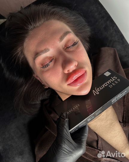 Косметология увеличение губ