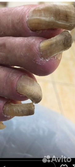 Услуги подолога. Педикюр эстетика