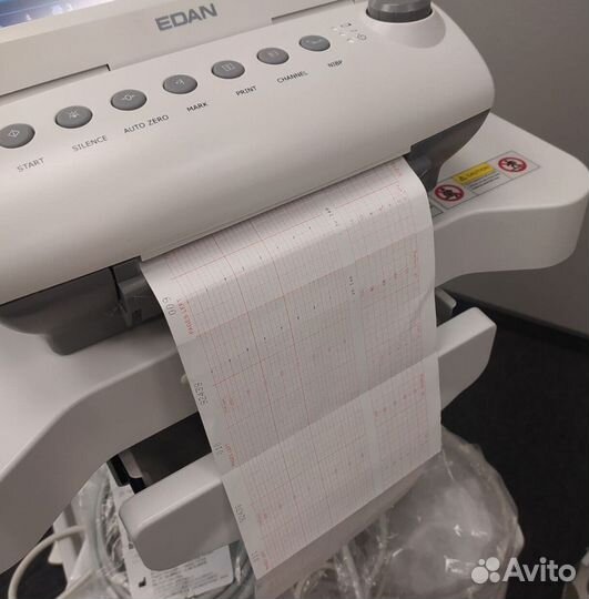 Монитор фетальный