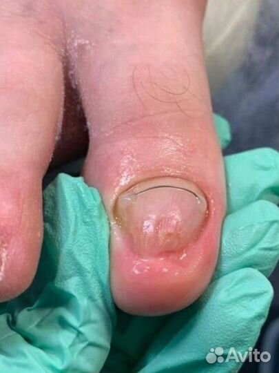 Подолог в центре