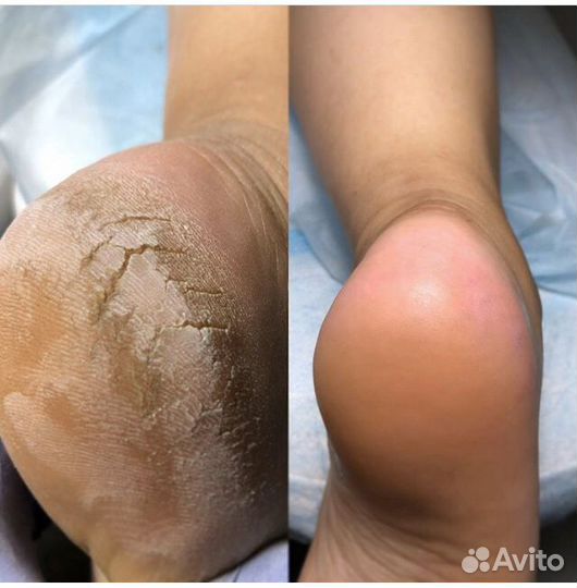 Smart педикюр ламинирование ресниц. звоните