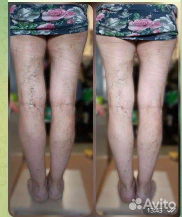 Массаж и обертывание,лечение волос