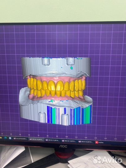 Exocad программа 3.1 Оригинал