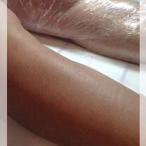 Электроэпиляция, метро Аэропорт, салон Бьянка Люкс, Москва