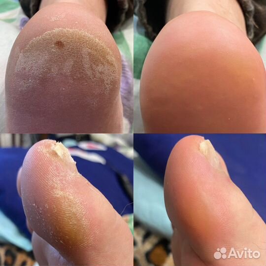 Маникюр,педикюр,подология