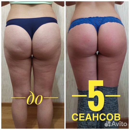 Массаж Всеволожск