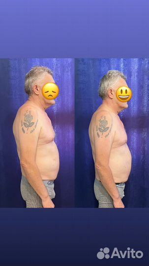 Висцеральные правки/Моделирующий массаж