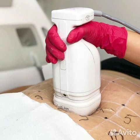 Липосоникс-Безоперационная Липосакция