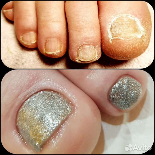 Педикюр (смарт) Норильск