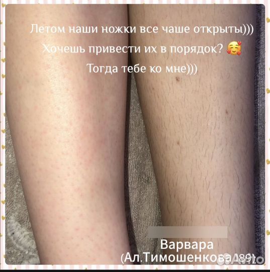 Восковая депиляция