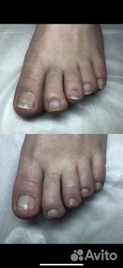 Смарт педикюр