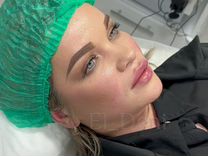 Обучение инъекционной косметологии Full Face,губы