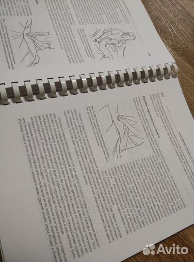 Триггерные точки. Авторская методика лечения боли