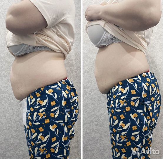 Жиротоп. Липолитики для тела у топ-косметолога