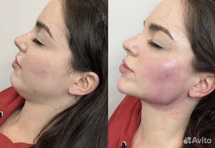 Нужны Модели косметологу