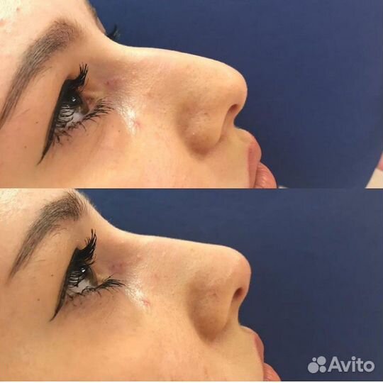 Преоб-ра-же-ние