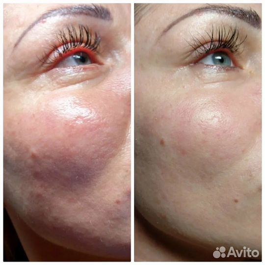 Косметолог- чистка лица, массаж, пилинг