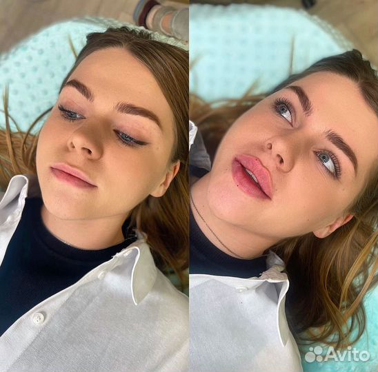 Косметолог. Контурная пластика, лицо под ключ