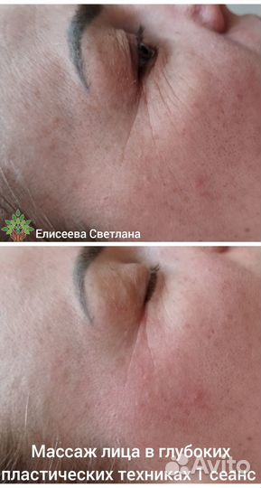 Массаж лица и тела. Остеокоррекция. Оздоровление