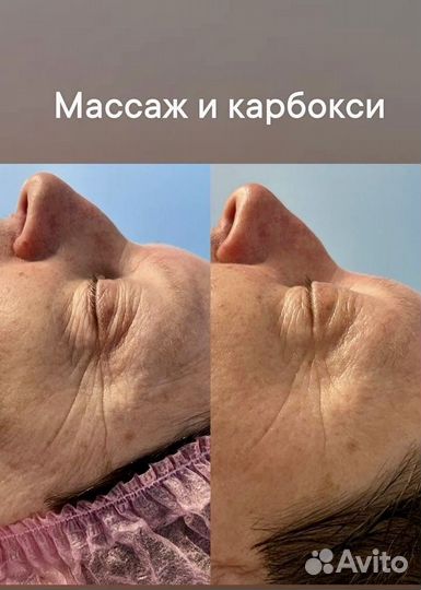 Массаж лица, чистка, уходы, косметолог