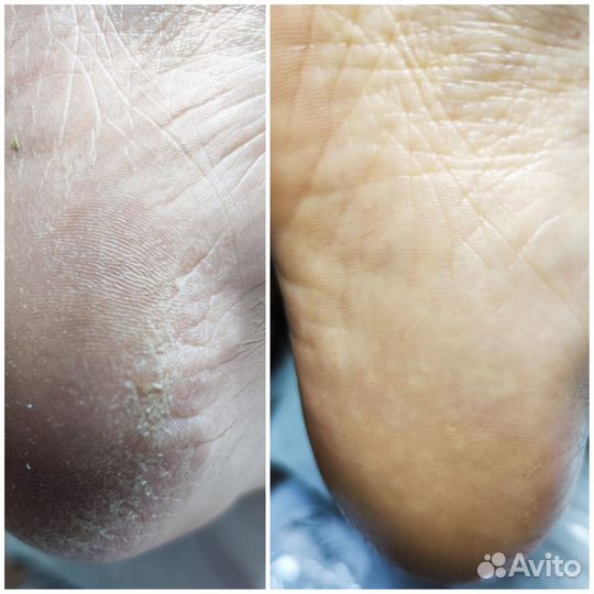 Смарт педикюр. Метро звёздная