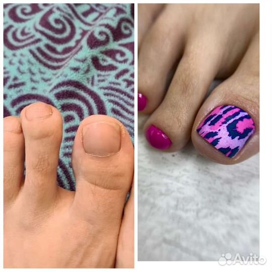 Аппаратный педикюр