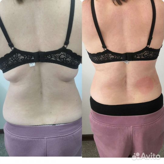 Худеем быстро и надолго