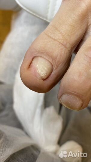 Услуги подолога