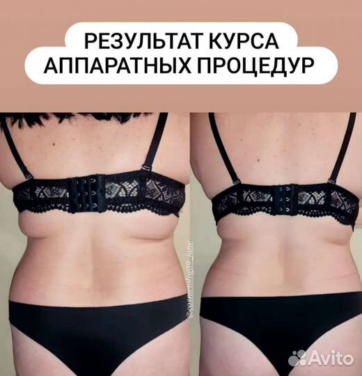 Кавитация,рф лифтинг,вакуум массаж,миостимуляция