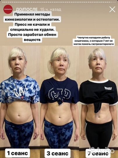 Кинезиолог. Лфк. Массаж. Остеопат. Омск