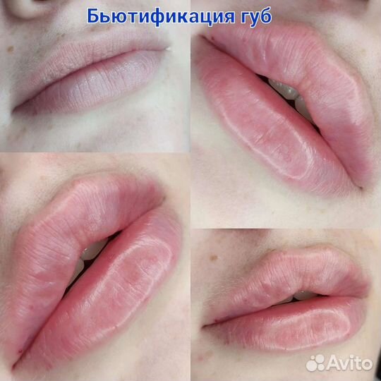 Бьютификация губ