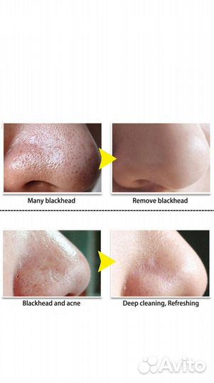 Маска от чёрных точек, анти акне, очистка пор