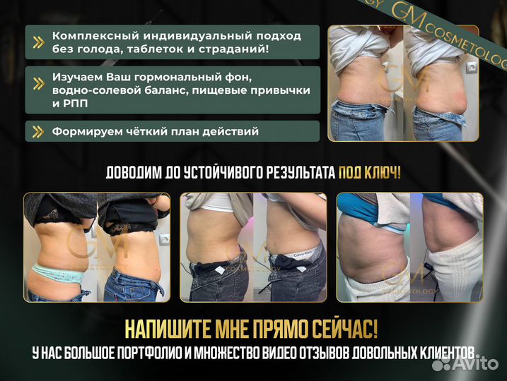 Похудение за 1 сеанс, липолитики, коррекция фигуры