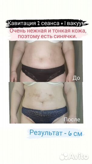 Массаж и Аппаратные процедуры по телу в Муроме