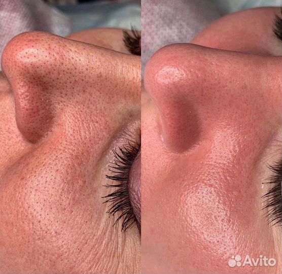 Косметолог - эстетист