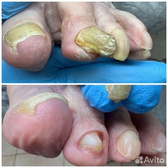 Услуги подолога