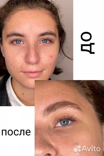 Архитектура бровей