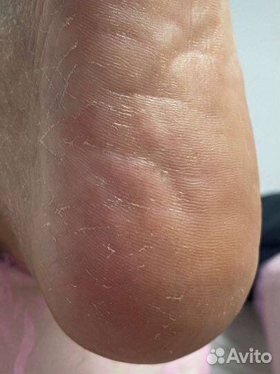 Услуги подолога