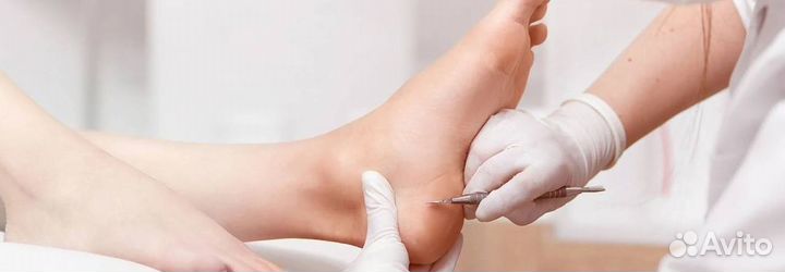 Медицинский педикюр подолог москва